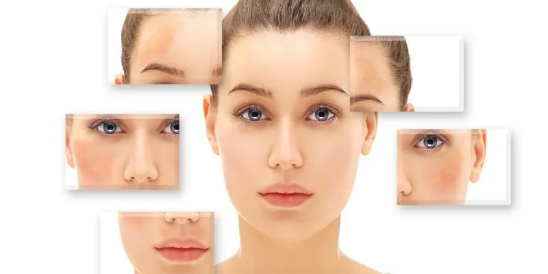 Công nghệ Laser điều trị nám sâu